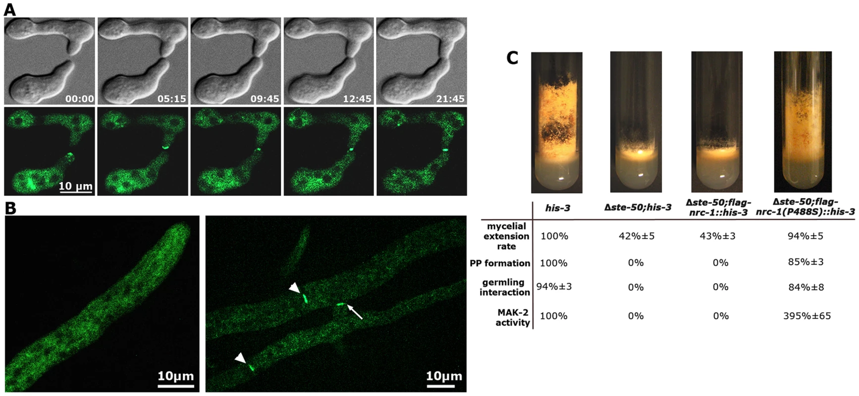 STE-50 functions as regulatory subunit of NRC-1.