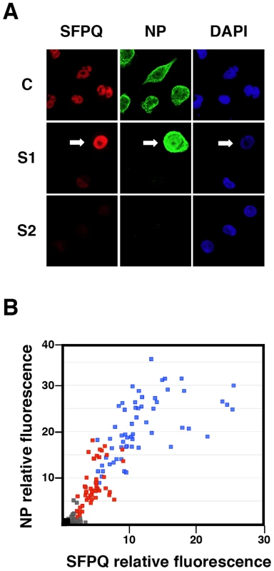 Cytological analysis of influenza virus infection of SFPQ/PSF-silenced cells.