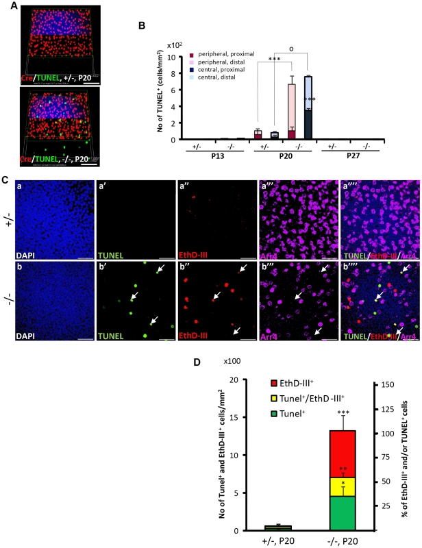Spatiotemporal modalities of cell death between Cre<sup>+</sup>, Arr4<sup>+</sup> and Arr4<sup>−</sup>-photoreceptor cell bodies in <i>HRGP-cre:Ranbp2<sup>−/−</sup></i>.