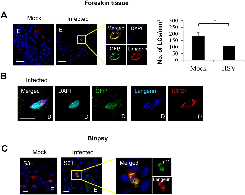 HSV-1 infected LCs in human skin.