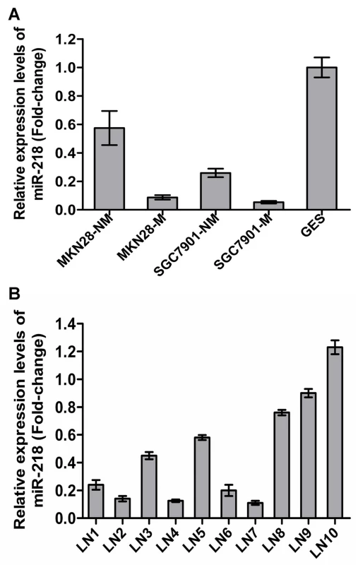 Validation of miR-218 expression in metastatic GC cells.