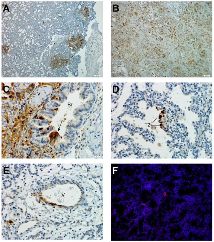 Nipah virus tropism in human lung xenografts.