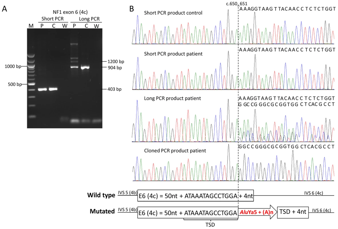 Example of <i>de novo Alu</i> insertion detection by improved PCR conditions.