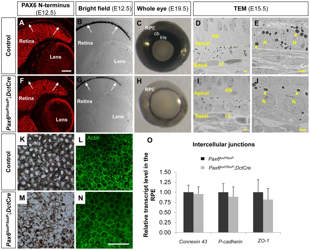 PAX6 expression is essential for proper pigment accumulation in the RPE but dispensable for RPE polygonal and single layer morphology.