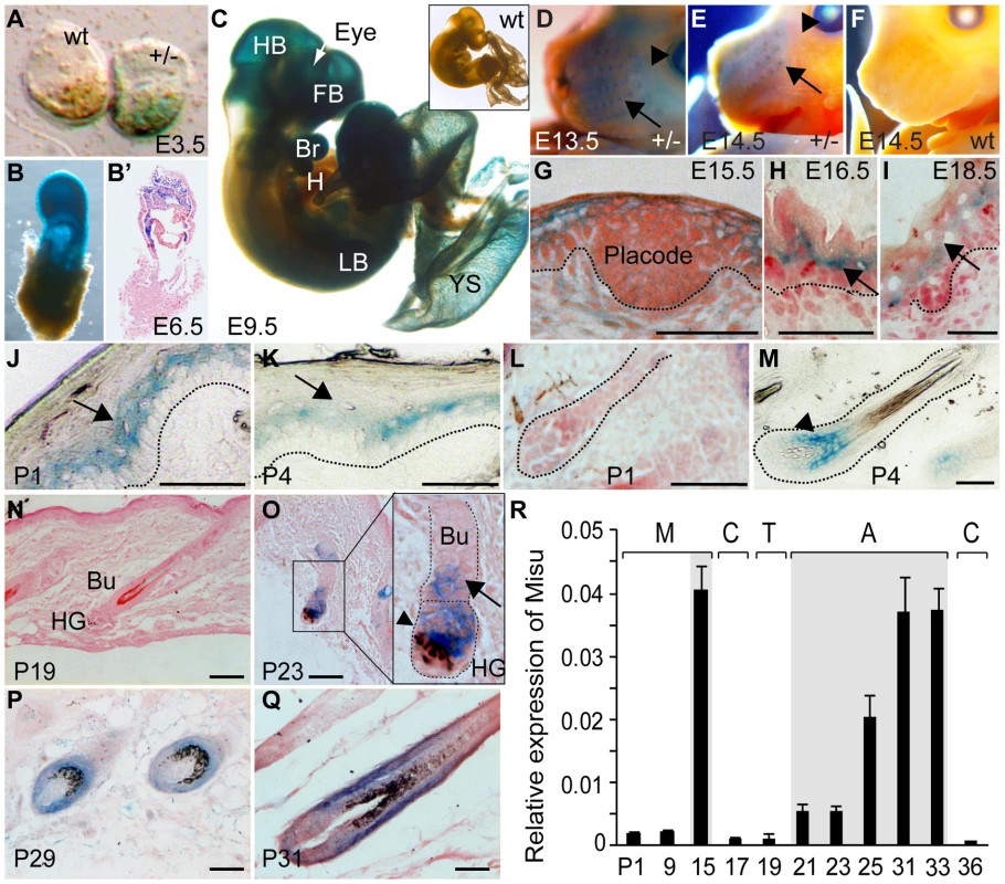 Expression of Misu during embryogenesis, skin morphogenesis, and in adult epidermis.