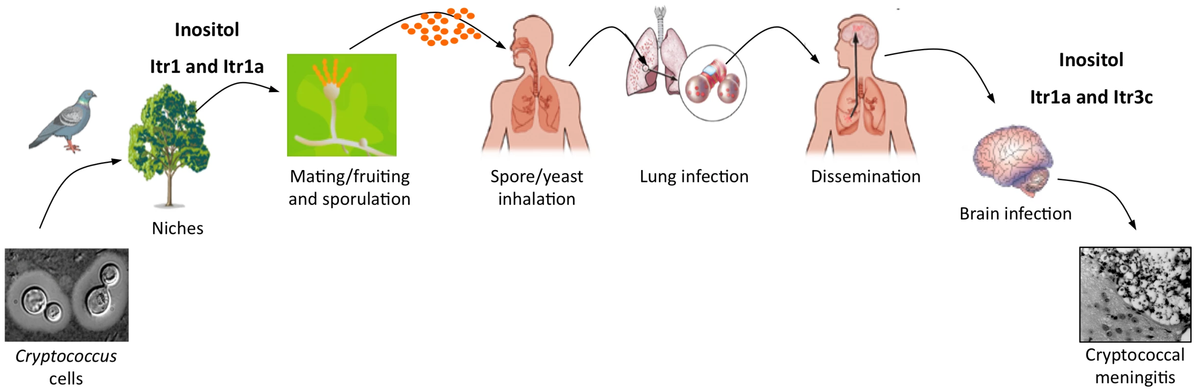 A model of how inositol affects the infection cycle of <i>C. neoformans</i>.
