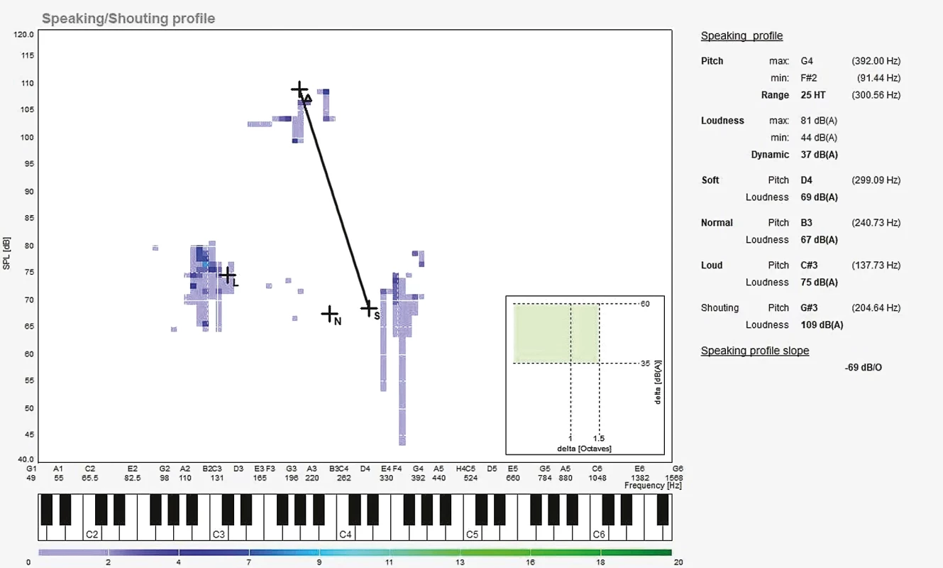 Hlasová analýza 2 roky po operaci. // Fig. 2. Voice analysis 2 years after surgery.