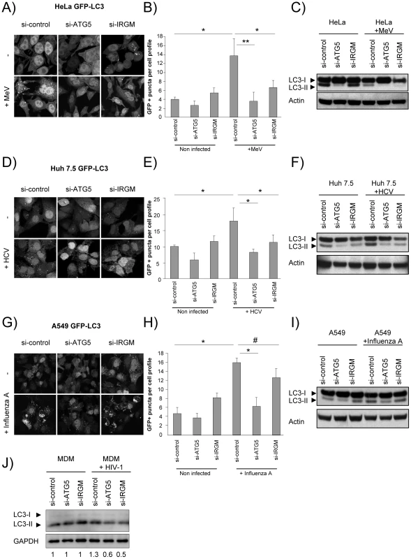 MeV, HCV and HIV-1-induced autophagosome accumulation is dependent on IRGM.