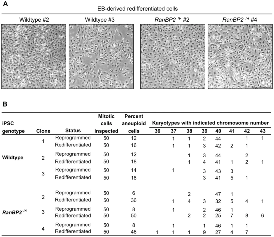 RanBP2 hypomorphic iPSCs reestablish W-CIN after redifferentiation.