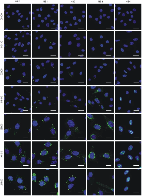 NS4 expression profile.