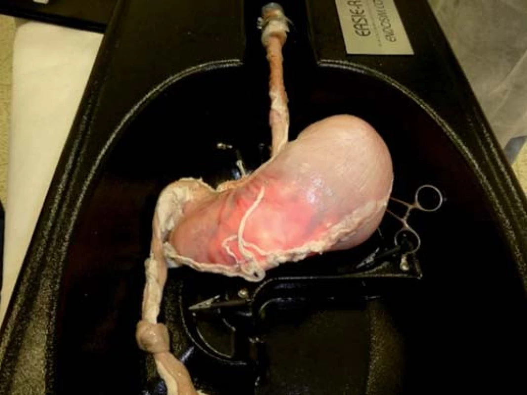 Animální model vytvořený z jícnu, žaludku a dvanáctníku prasete (EASIE, Erlangen Active Simulator for Interventional Endoscopy).
Fig. 2. Animal model generated from pig oesophagus, stomach and duodenum (EASIE, Erlangen Active Simulator for Interventional Endoscopy).