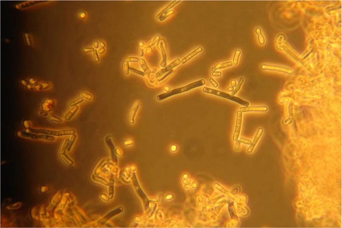 Microscopy of <i>T. mycotoxinivorans</i> showing arthroconidia, 400-fold magnification