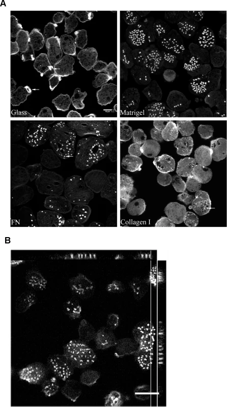 Host ECM components induces actin rearrangement in <i>Entamoeba histolytica</i>.