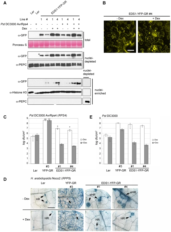 Nuclear release of EDS1-YFP-GR by Dexamethasone (Dex) treatment leads to protein accumulation in nuclei and enhanced disease resistance.
