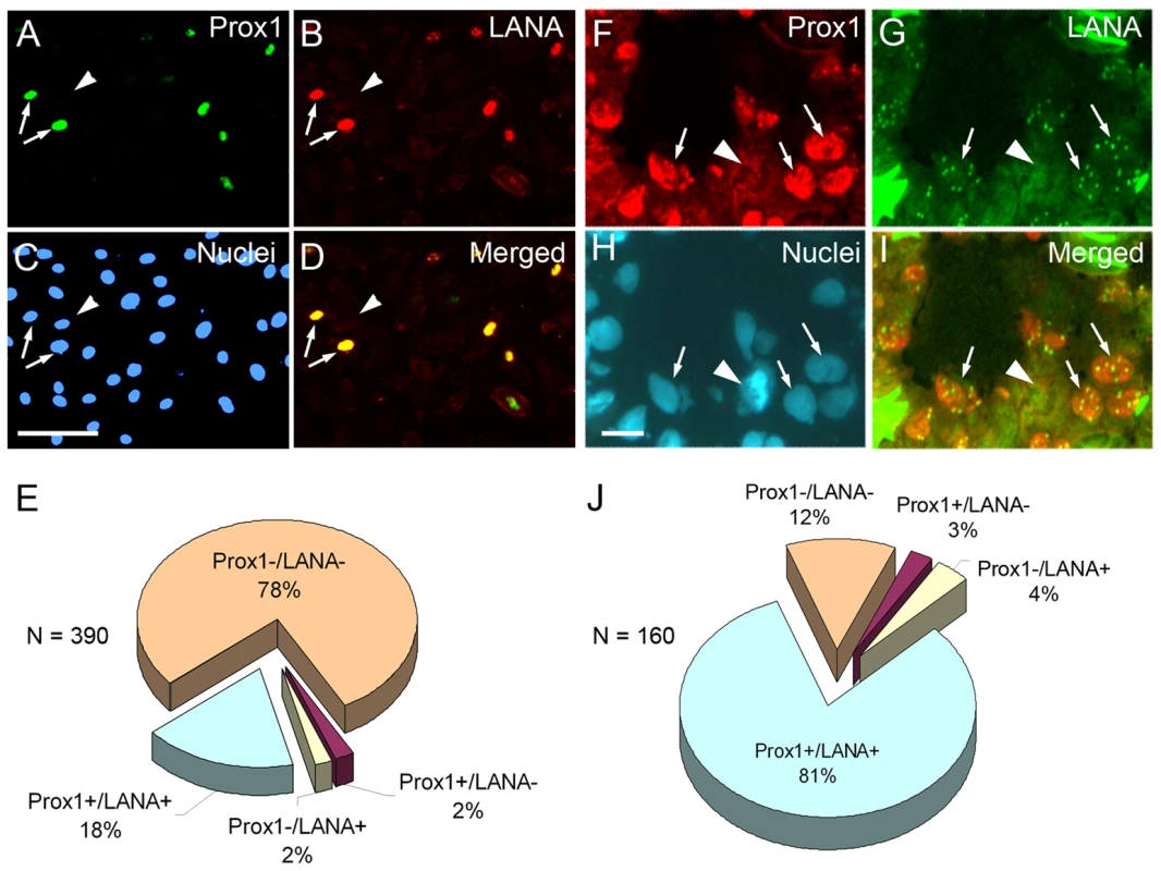 PROX1 is upregulated only in KSHV-infected endothelial cells <i>in vitro</i> and <i>in vivo</i>.