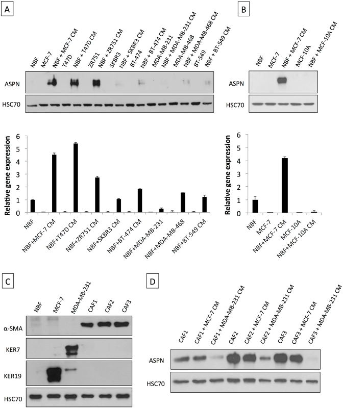 Asporin is produced by breast fibroblasts in response to conditioned medium from breast cancer cells.