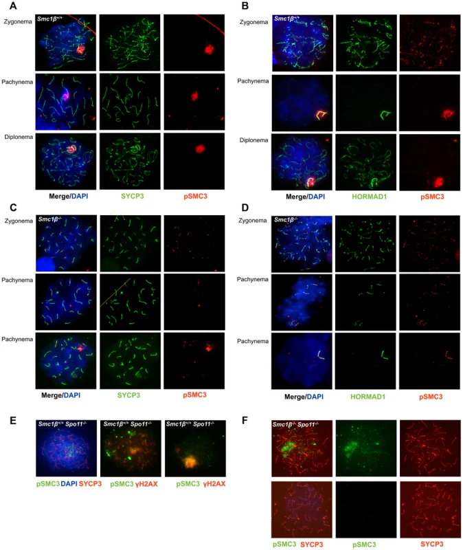 Phosphorylated SMC3 distinctly localizes to asynaptic regions in wt, <i>Smc1β<sup>−/−</sup></i>, and <i>Smc1β<sup>−/−</sup>Spo11<sup>−/−</sup></i> spermatocytes.