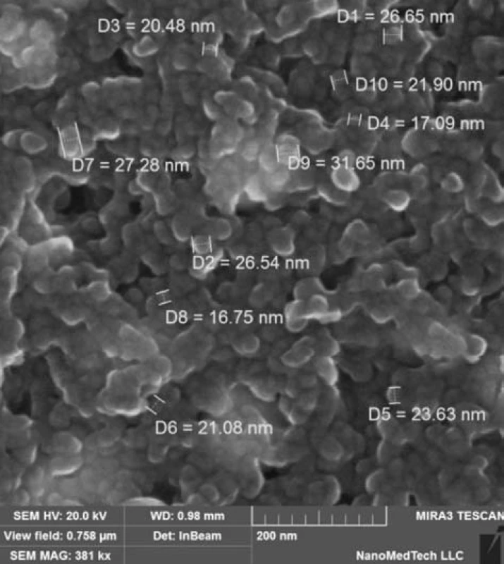 A picture of Ag@Fe<sub>3</sub>O<sub>4</sub> nanoparticles using an electron microscope