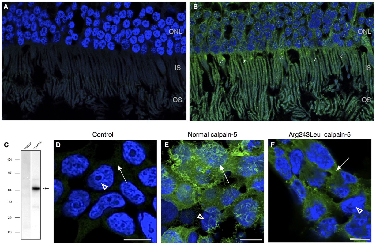 Calpain-5 expression in human retinal photoreceptor cells and cultured cells.