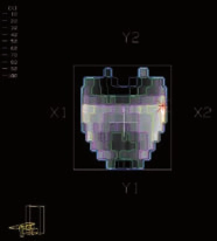 Modulace intenzity 
Fig. 6 Intensity modulation