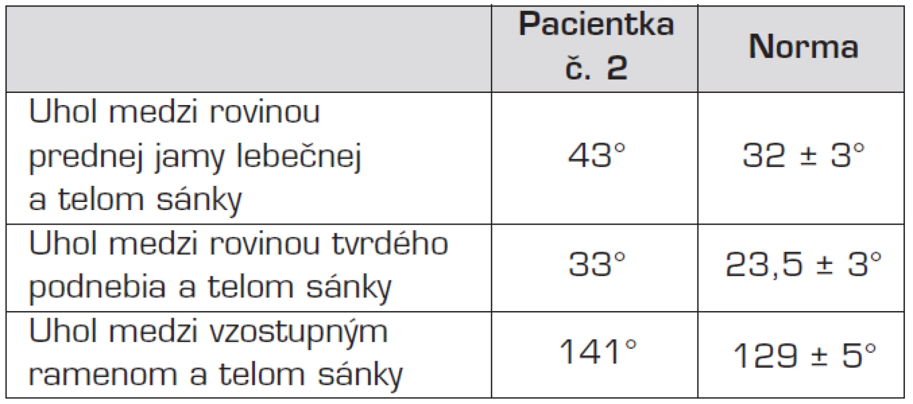 Porovnanie kefalometrických parametrov pacientky s priemernými hodnotami pre európsku populáciu. Evidentná je tendencia ku rastu sánky smerom dozadu a dole, čo vedie ku zvyšovaniu vertikálneho rozmeru dolnej tretiny tváre.
