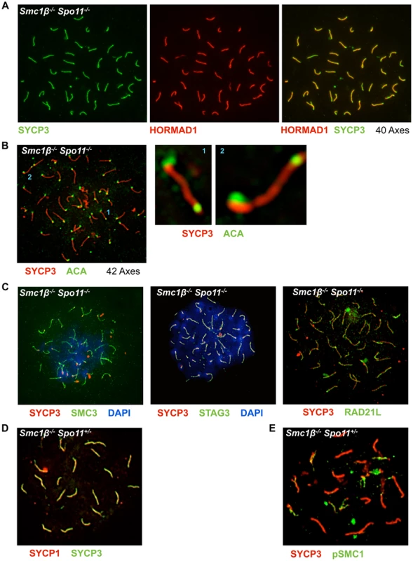 Non-homologous association of axial elements depends on SMC1β.