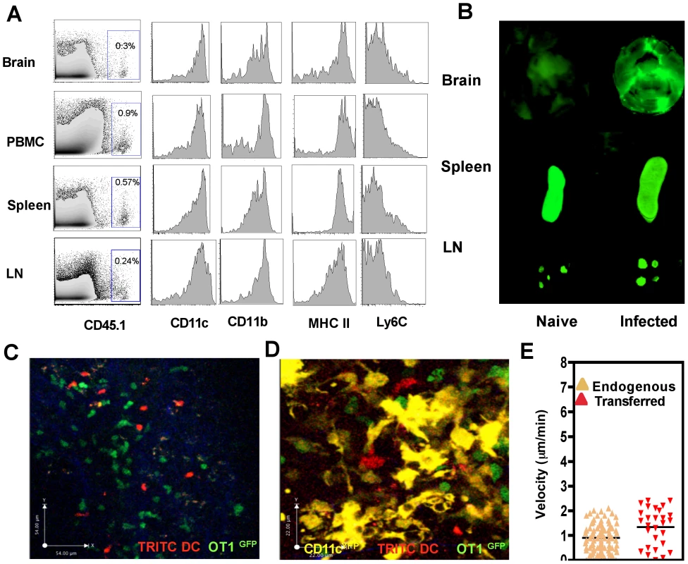 Adoptively transferred DCs migrate from the periphery into the inflamed brain.