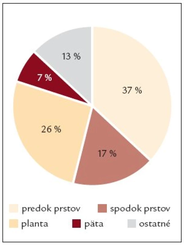 Lokalizácia ulcerácií na nohách diabetikov (n = 124).