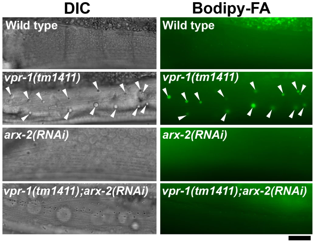 Effect of Arp2/3 inactivation on muscle fat levels.