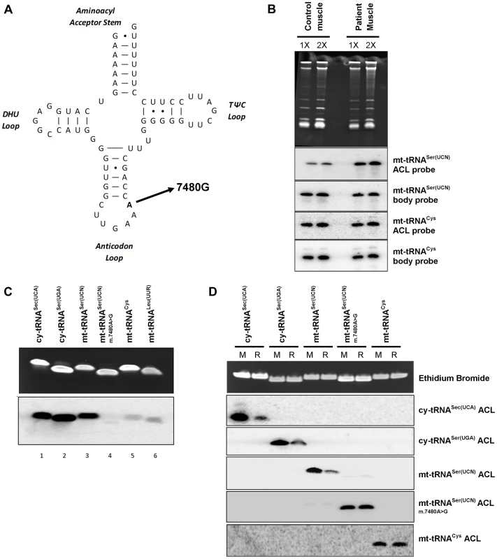 A mt-tRNA<sup>Ser(UCN)</sup> point mutation, m.7480A>G, impairs i<sup>6</sup>A37 modification.