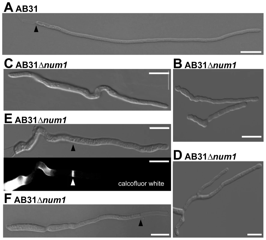 Num1 is required for polar growth and septum formation.