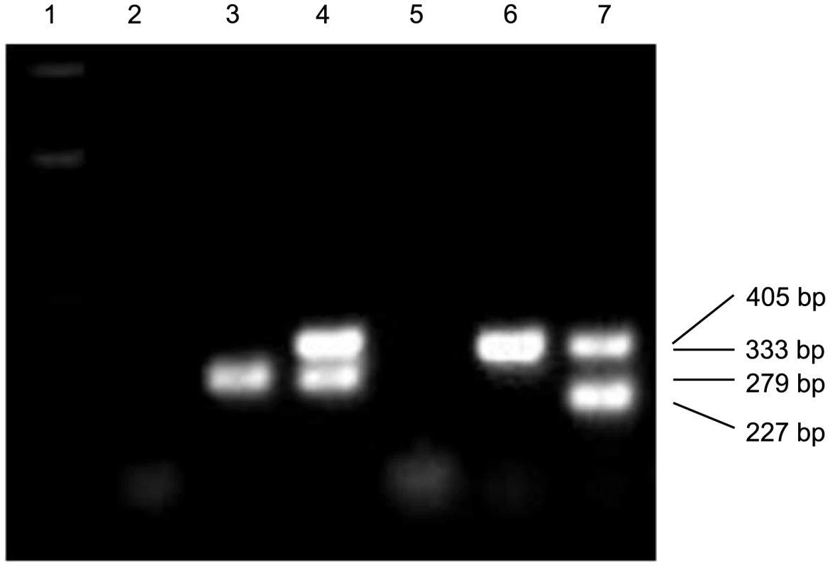 PCR analysis of the twinned alleles with primers 1+2+Ac5.