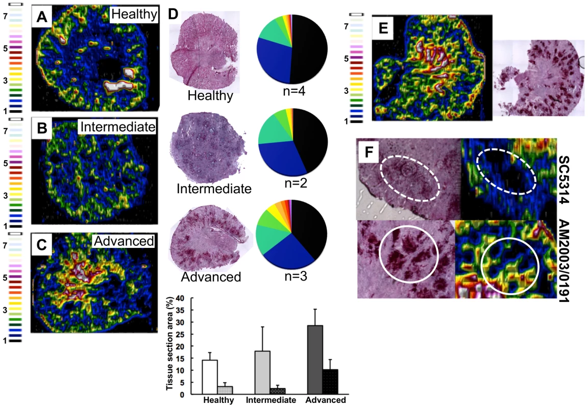 <i>C. albicans</i> infection is accompanied by dramatic changes in the renal iron landscape.