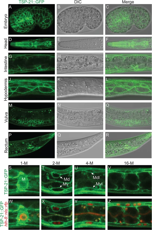 TSP-21 is localized to the plasma membrane of multiple cell types, including known Sma/Mab signal-receiving cells.