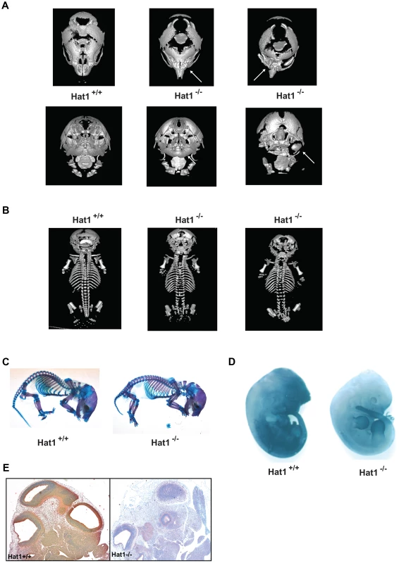 Skeletal defects associated with the loss of Hat1.