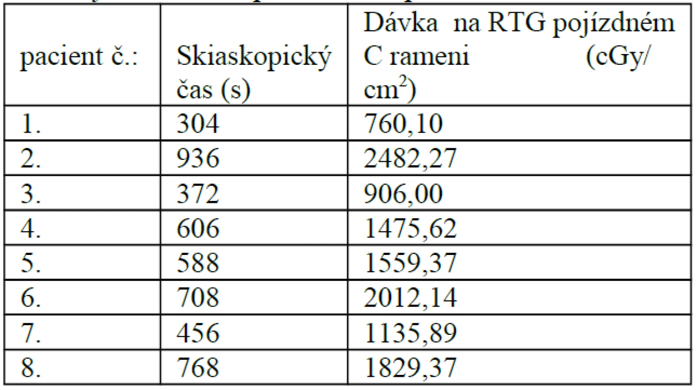 Osteosyntéza UFN pod skiaskopickou kontrolou