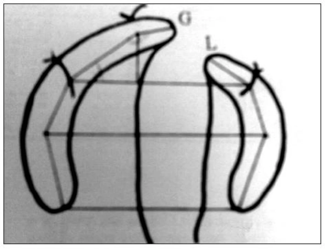 Identifikácia antropometrických bodov; Zdroj: Mazaheri et al. (1971)
Fig. 3. Identification of antropometric points; Source: Mazaheri et al. (1971)