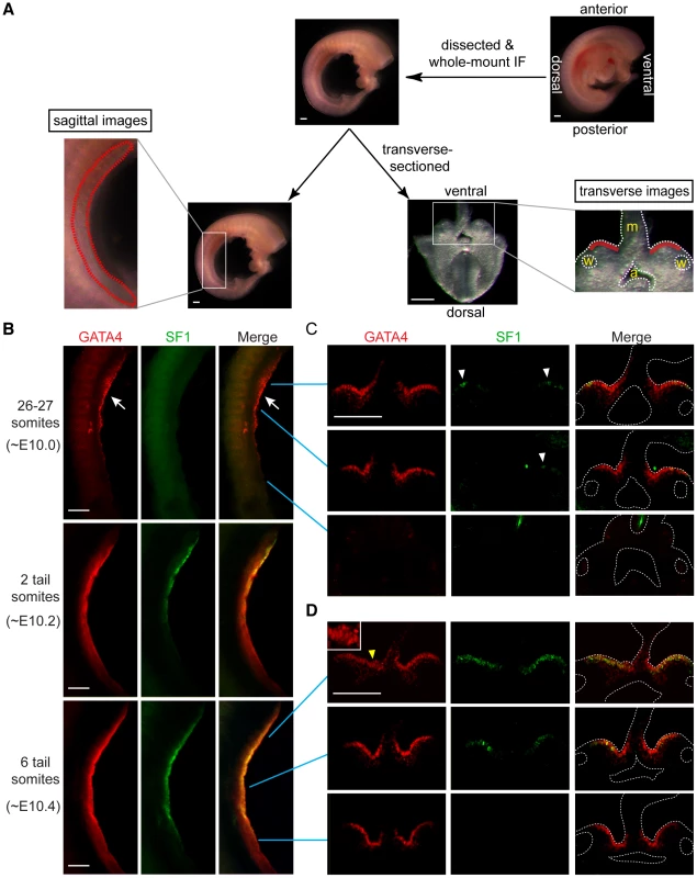 GATA4 expression precedes coelomic epithelial thickening and progresses from anterior to posterior.