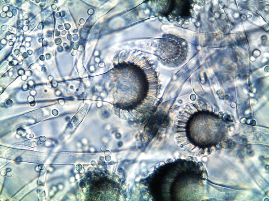 Aspergillus fumigatus v optickém mikroskopu (foto autorka)
Figure 3. Aspergillus fumigatus under an optical microscope (photo by the author)