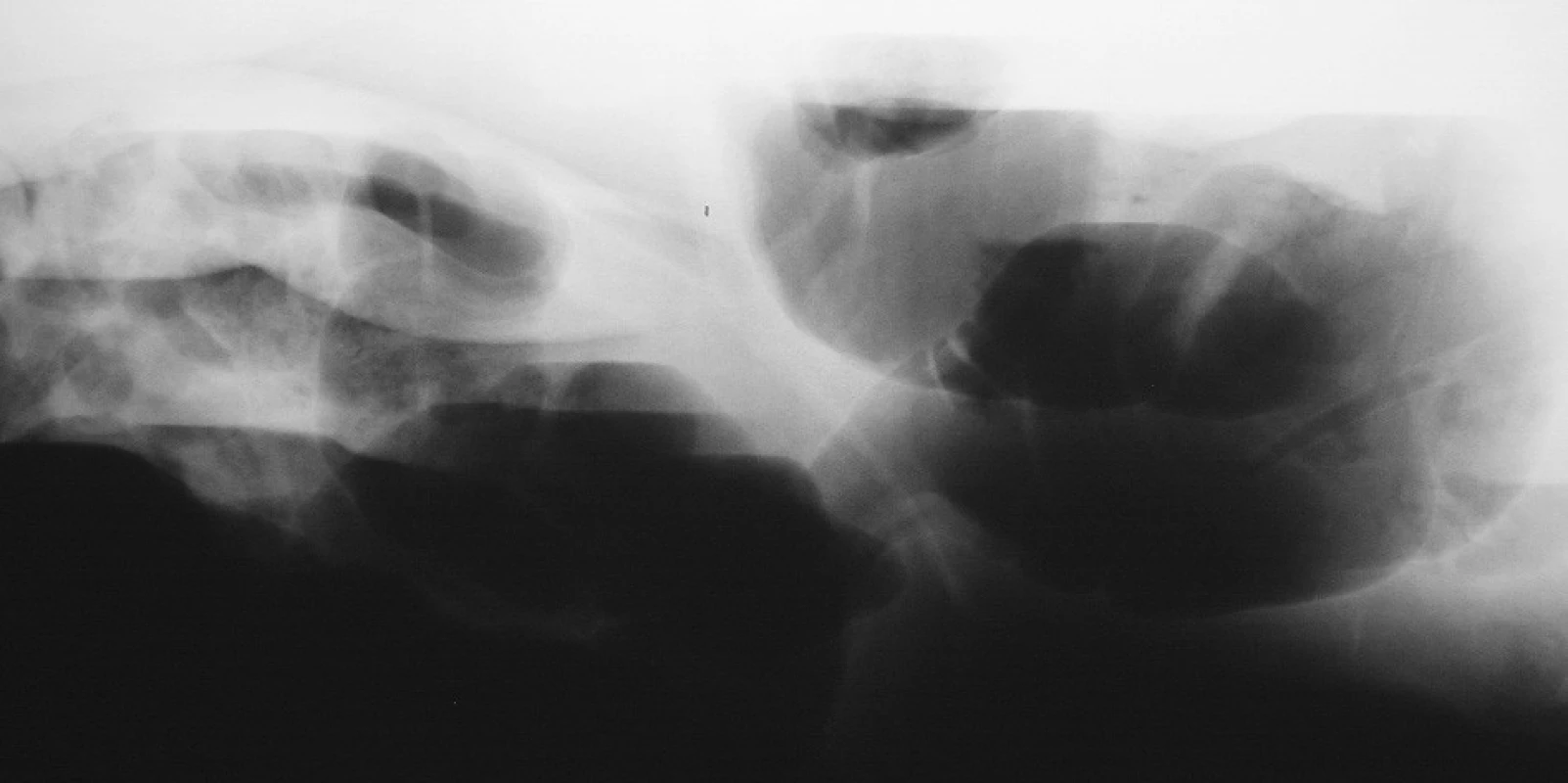 Laterogram břicha
Fig. 2. Laterogramm of the abdomen