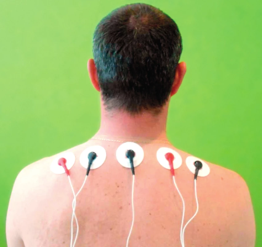 Uloženie snímajúcich elektród.
