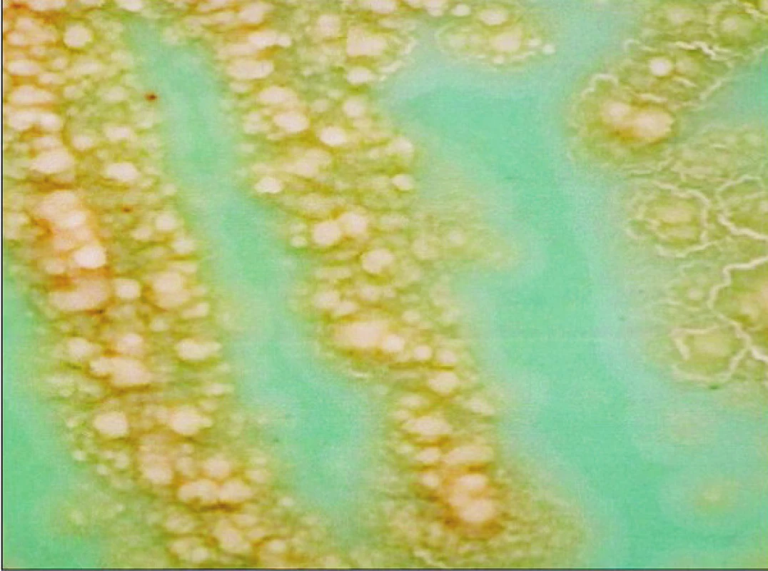 Kolonie <i>Mycobacterium tuberculosis</i> na Ogawově kultivační půdě