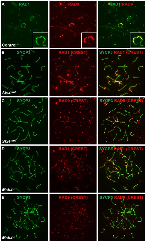 RAD9 and RAD1 localize in overlapping yet distinct patterns on meiotic chromosomes.