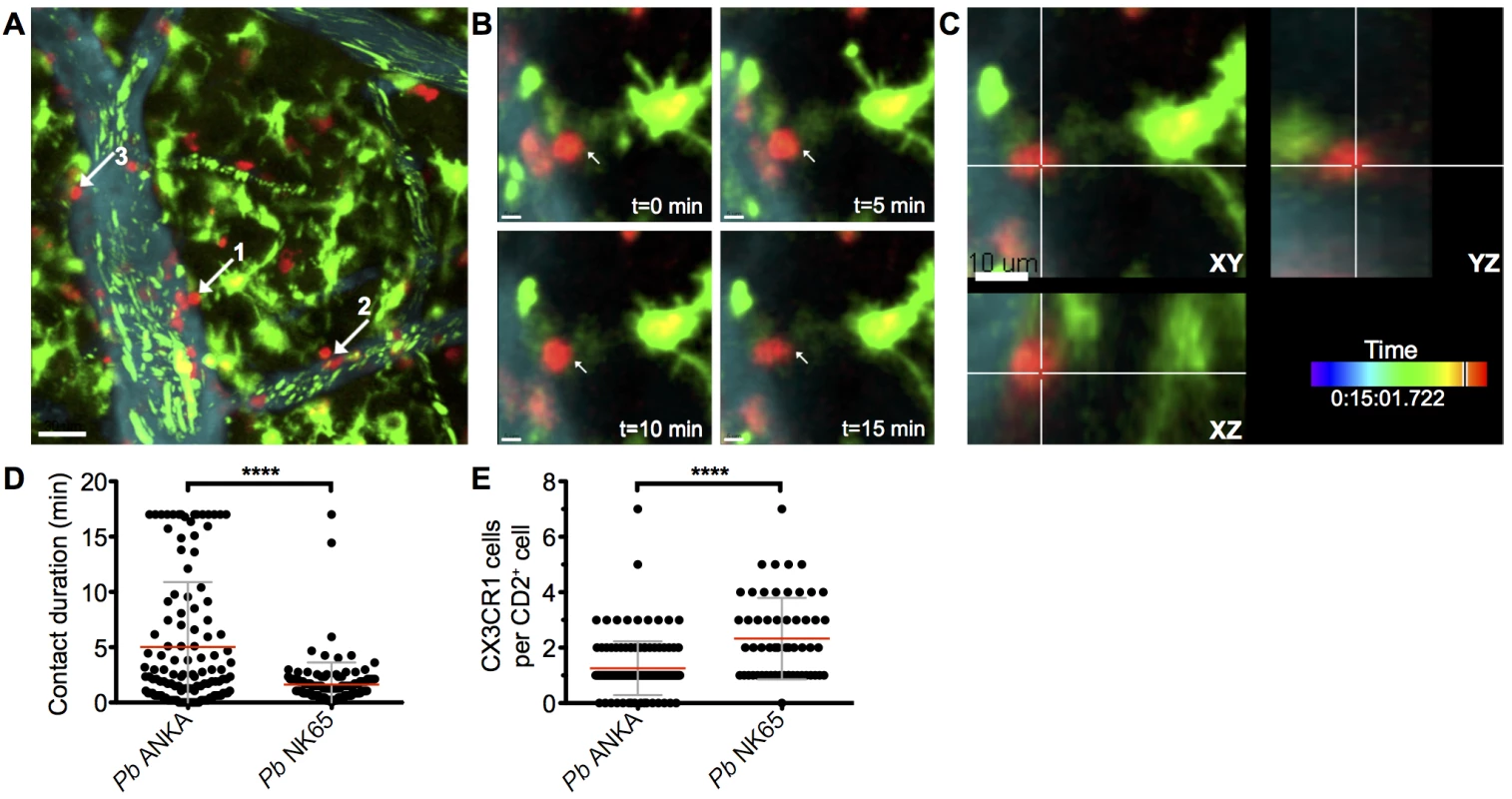 Perivascular T cells form long-lasting interactions with CX<sub>3</sub>CR1<sup>+/GFP</sup> in the brains of mice infected with <i>Pb</i> ANKA.