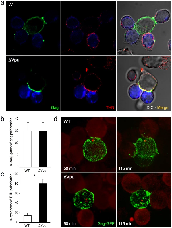 Tetherin accumulates with Gag at the virological synapse.