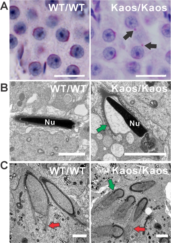 Acrosome and manchette defects in <i>Lrguk</i><sup><i>Kaos/Kaos</i></sup> mice.