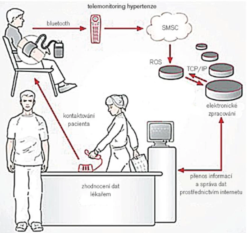 Schéma přenosu dat při telemonitoringu tlaku. SMSC – Short Message Service Counter, ROS – Remote Operation Service, TCP/IP – internetový protokol přenosu dat. Upraveno podle [19].