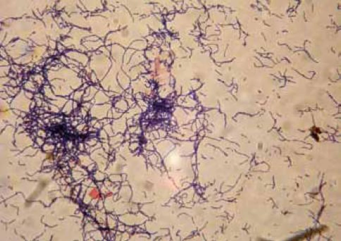 Kmen 08A Lactobacillus gasseri.