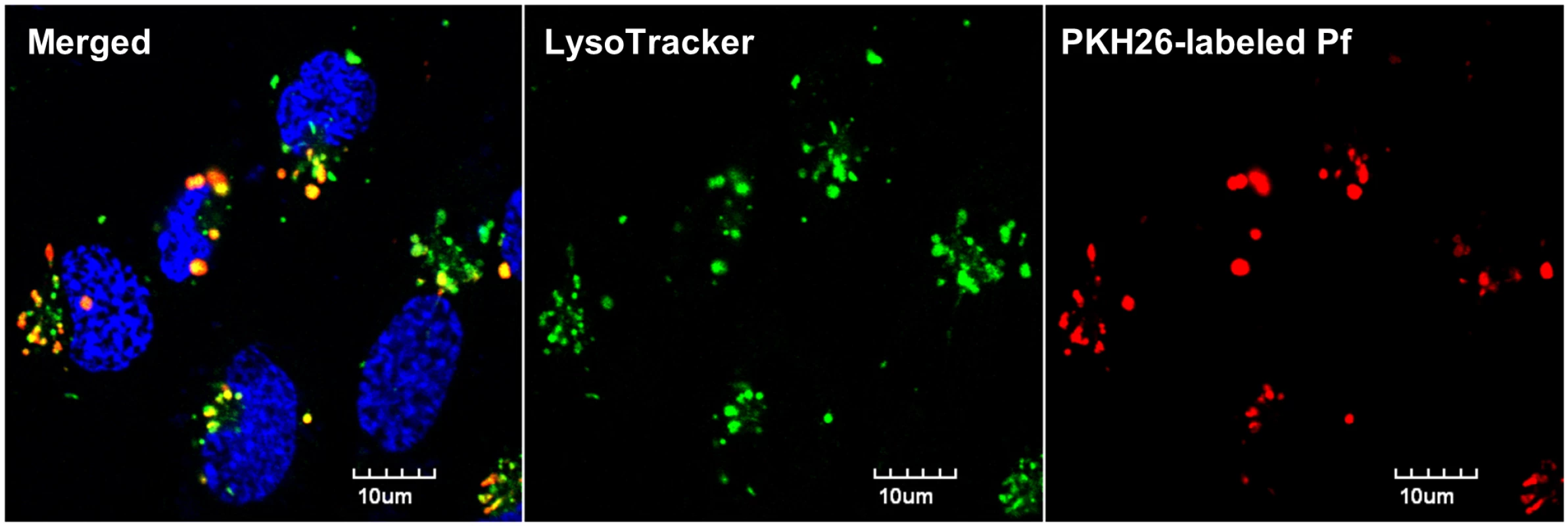 Human brain endothelial cells phagocytose Pf merozoites <i>in vitro</i>.
