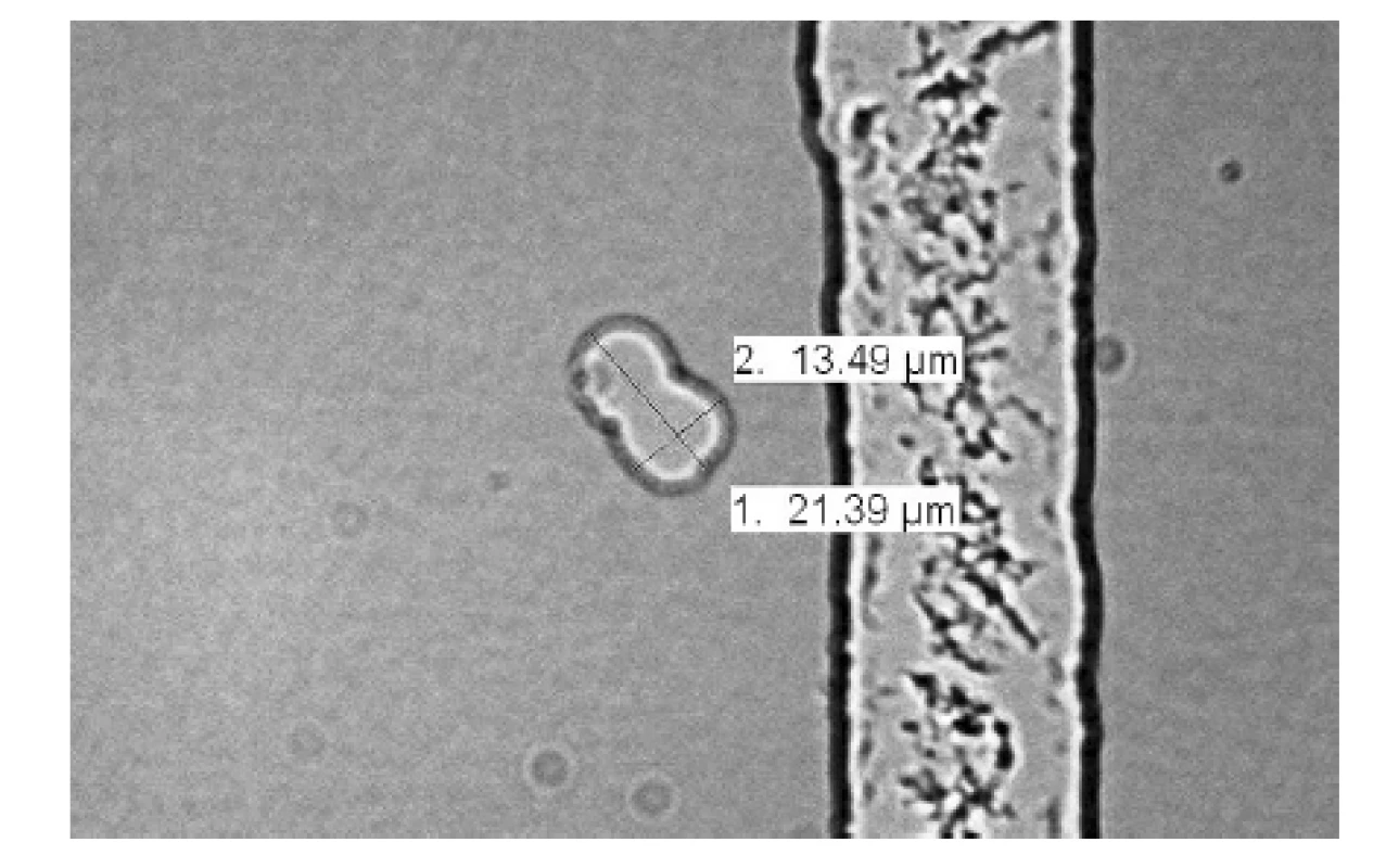 Mikroskopicky hodnocená morfologie krystalů fosforečnanů vápenatých – organická forma